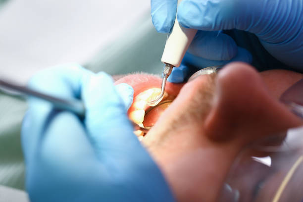 Best Emergency Care for Gum Disease in Booneville, MS