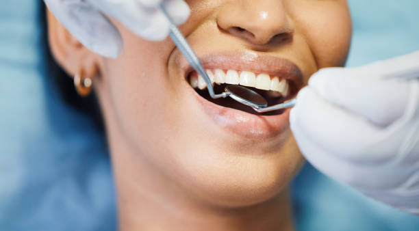 Best Emergency Dental Care for Sports Injuries in Booneville, MS